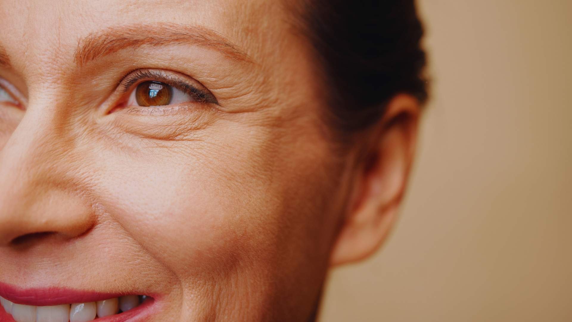 ¿Cómo eliminar las arrugas bajo los ojos? - Aragolaser - Clínica de medicina estética en Zaragoza