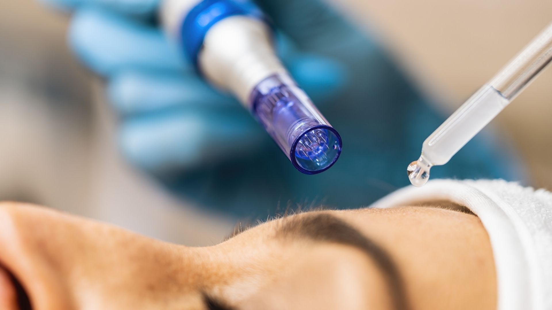 ¿Qué es la PRP facial? - Aragolaser