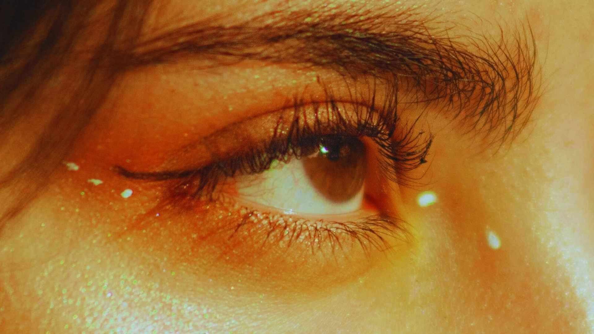 Los mejores tratamientos para eliminar hiperpigmentación facial en invierno - Aragolaser
